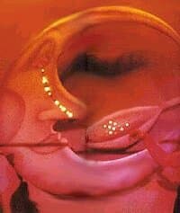 The Moon Man swung across the dance floor at Studio 54