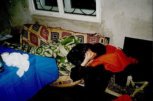 One of the signs of a severe hangover is a headache.